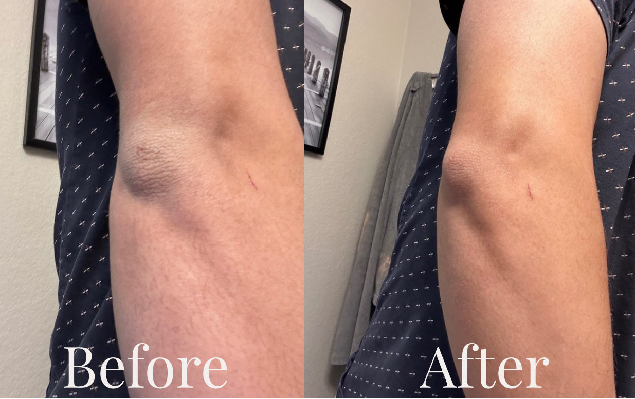 DripMoss Body Butter